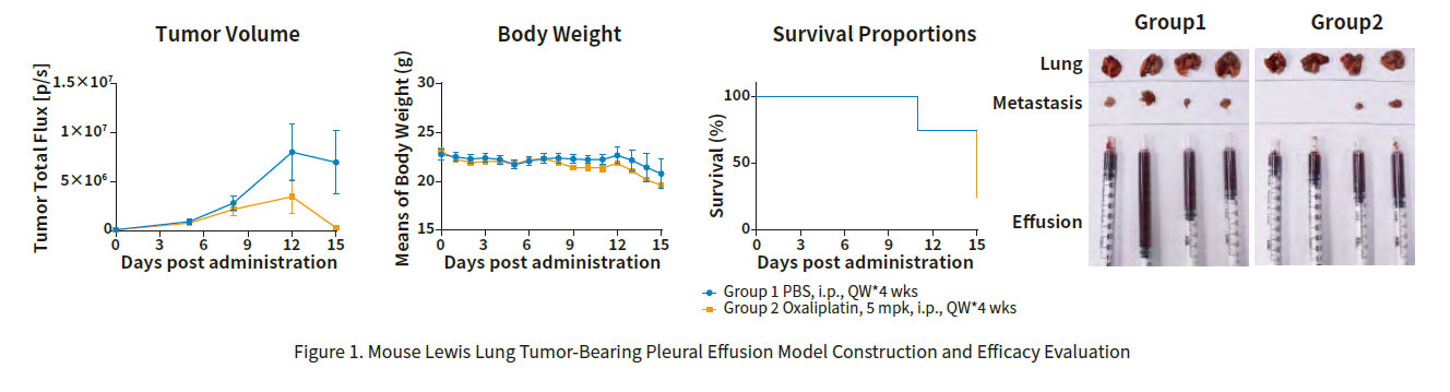 Pleural Effusion Model